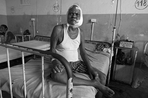Bhutanese refugee in hospital - Nepal
